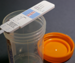 Drug Testing for Cocaine Abuse What You Need to Know